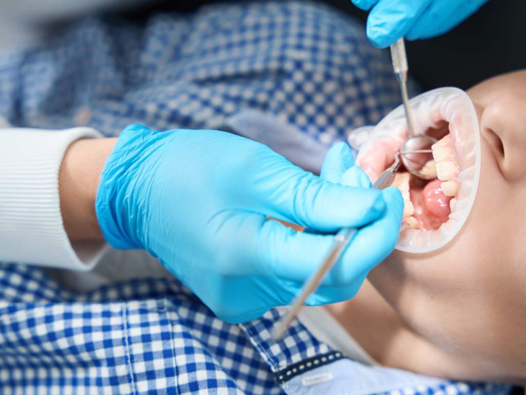 Cracked tooth repair