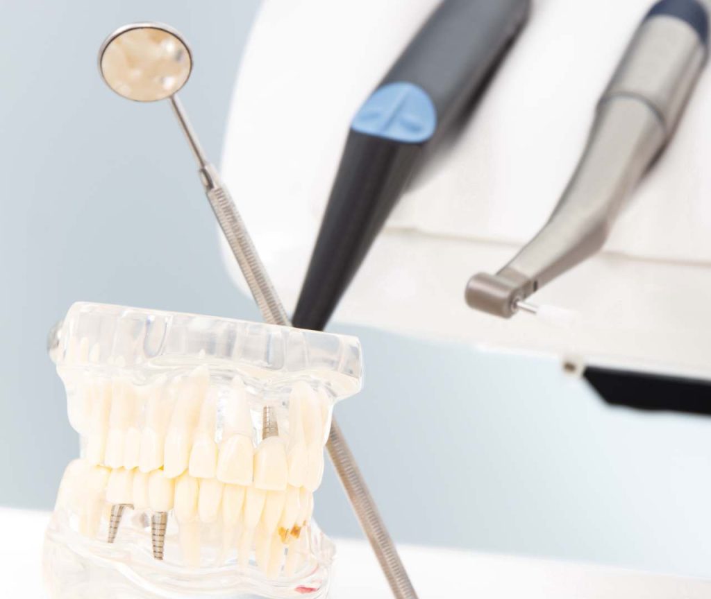Dental Bridge treatment