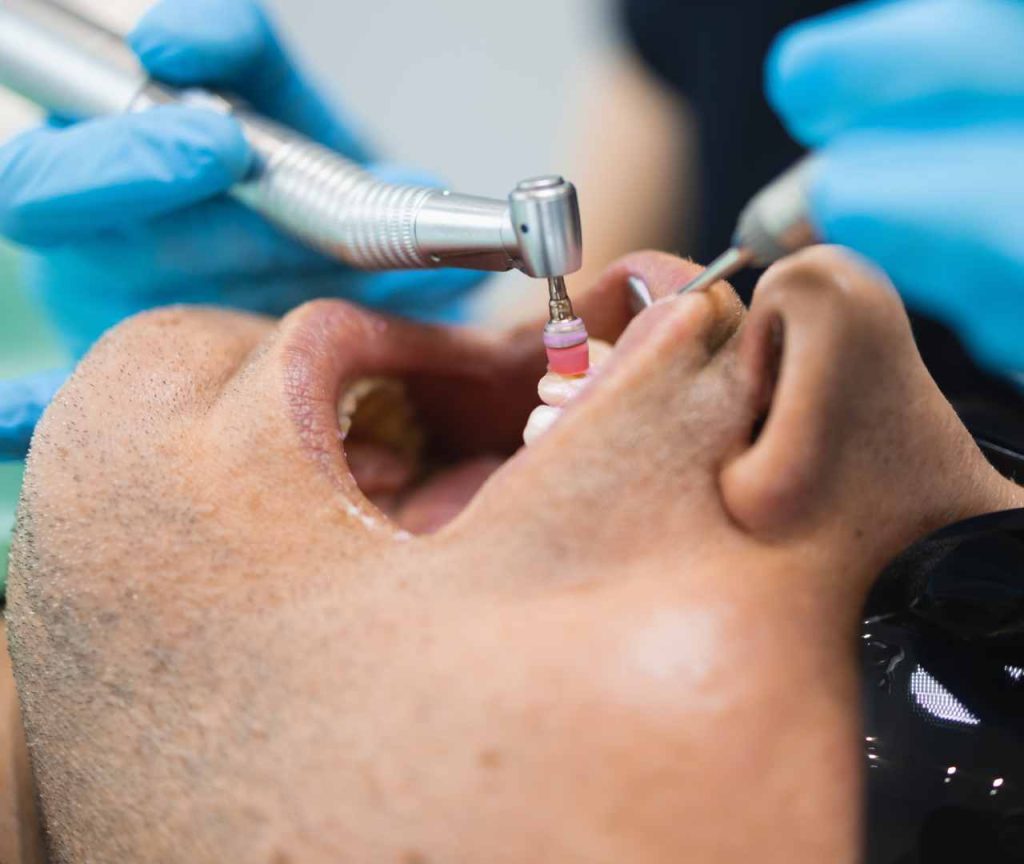 Professional Dental Cleanings