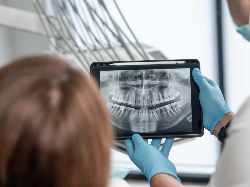 Dental Digital Xray