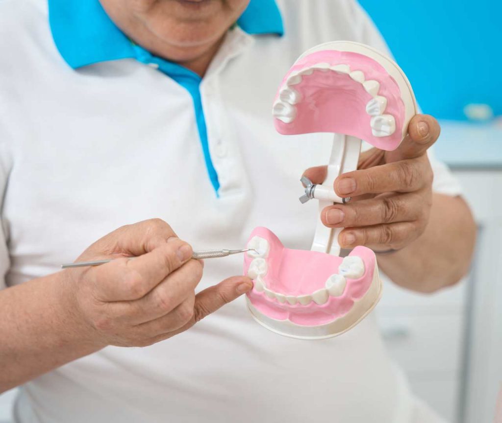 Dentures Partials