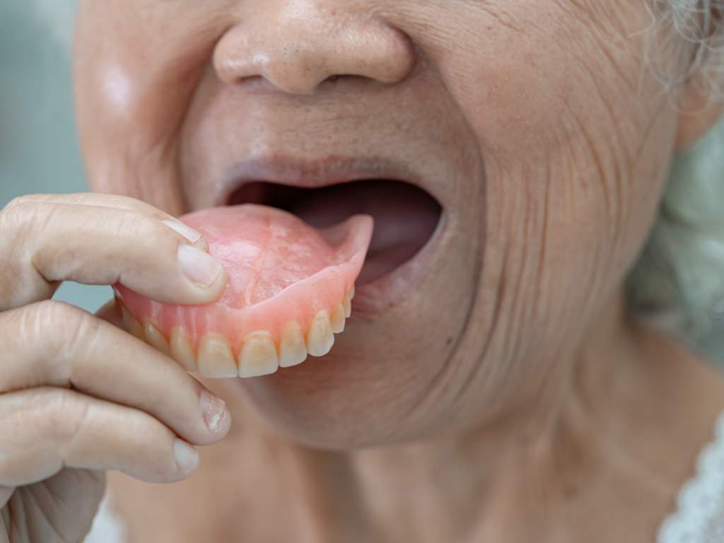 Loose Denture