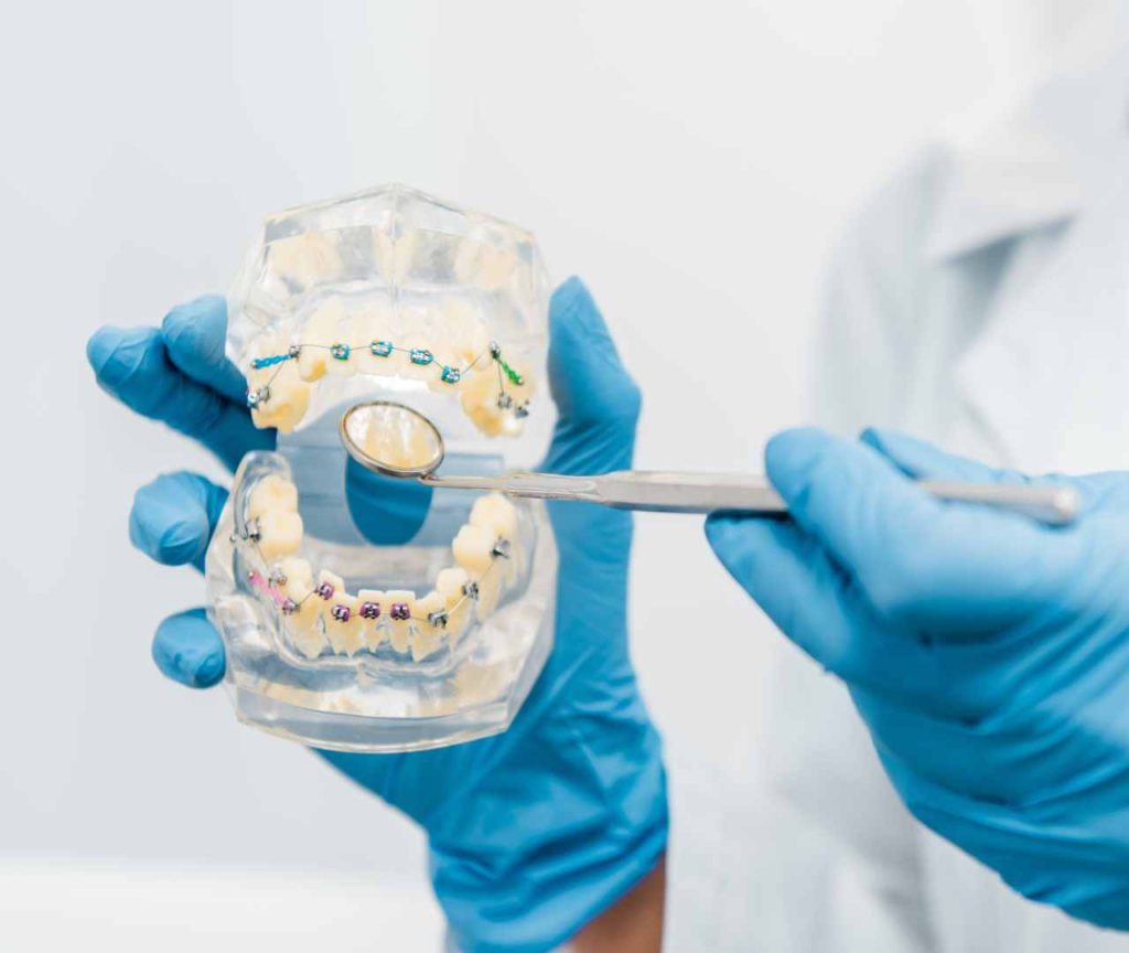 Orthodontics braces