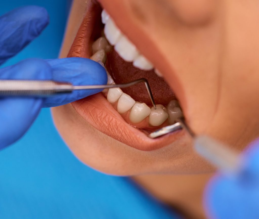 Periodontal