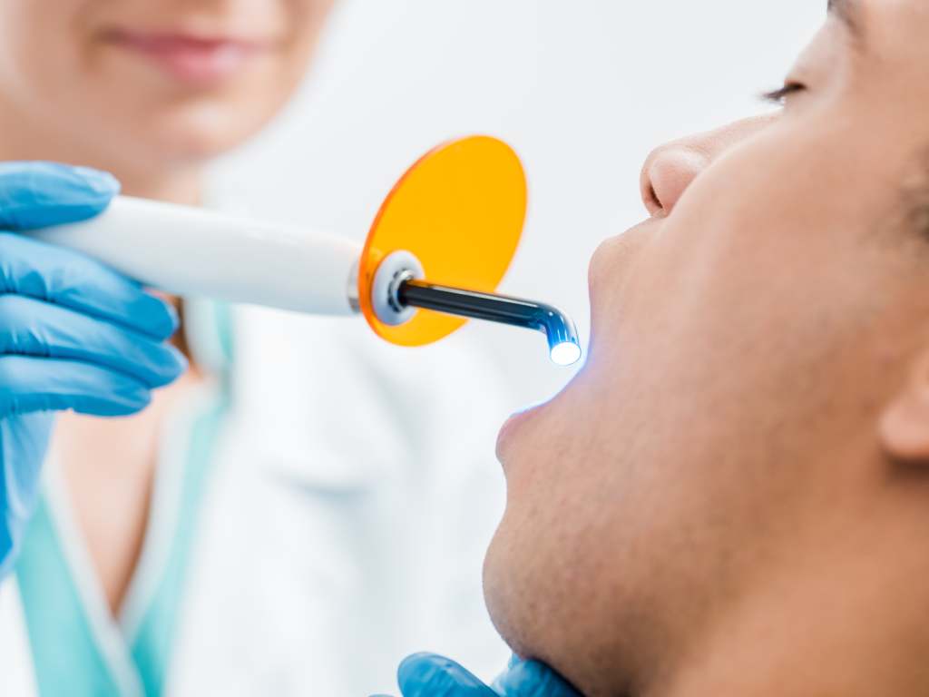 Sealants