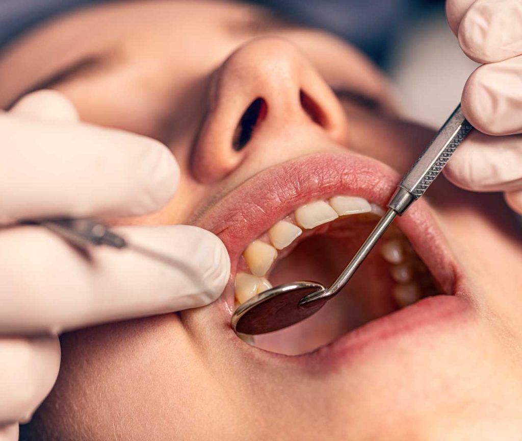 Sensitive Teeth Treatment