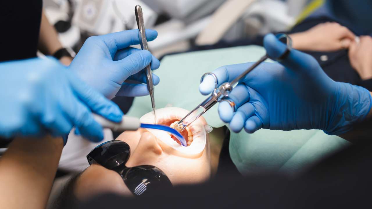 Tooth Extraction