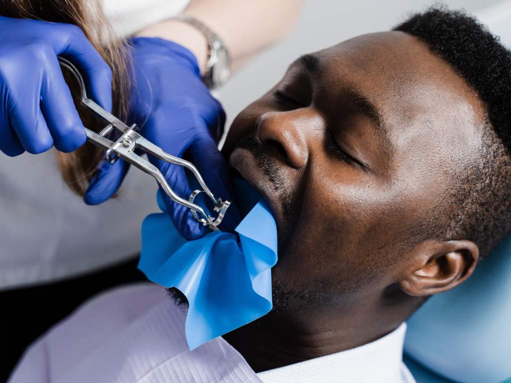 Tooth Extraction