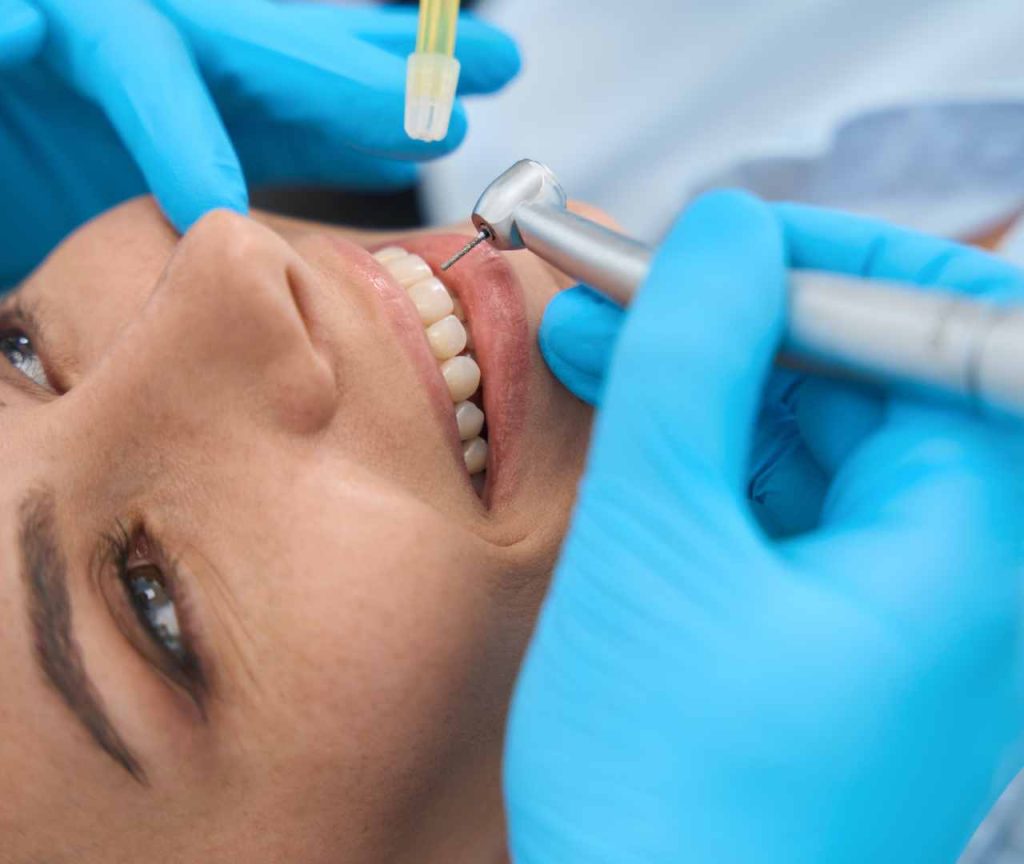 Tooth-Colored Fillings for a Natural Smile
