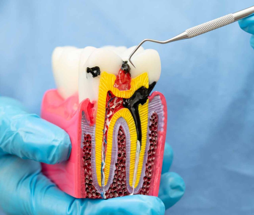 cavity problem