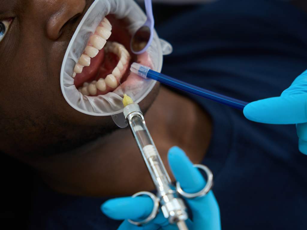 infected tooth Treatment
