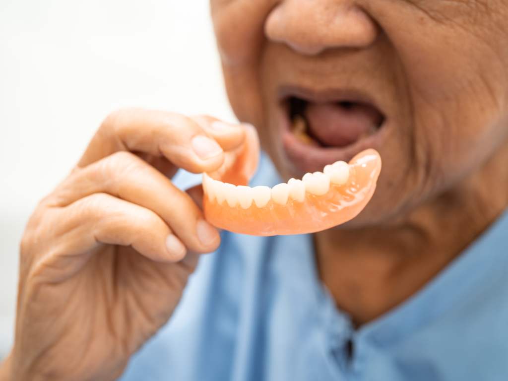 Partial Dentures