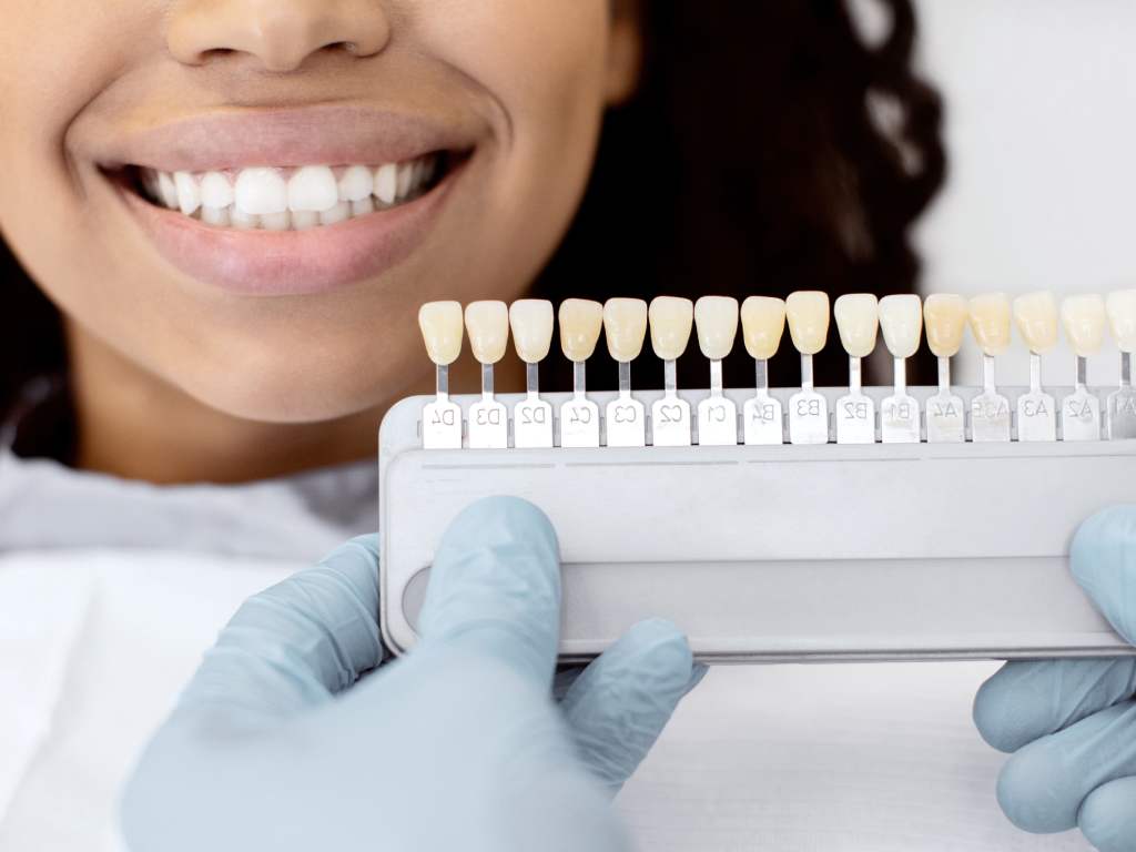 teeth whitening
