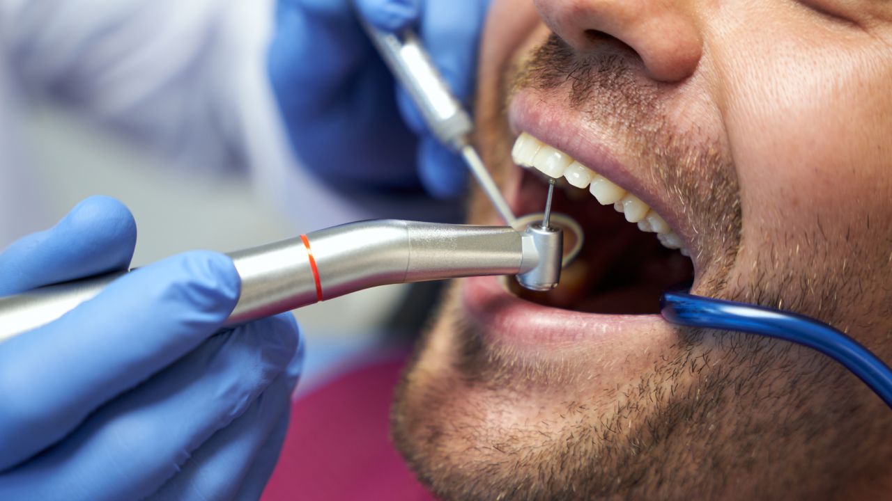 How Surgical Tooth Extraction Can Relieve Your Pain Fast