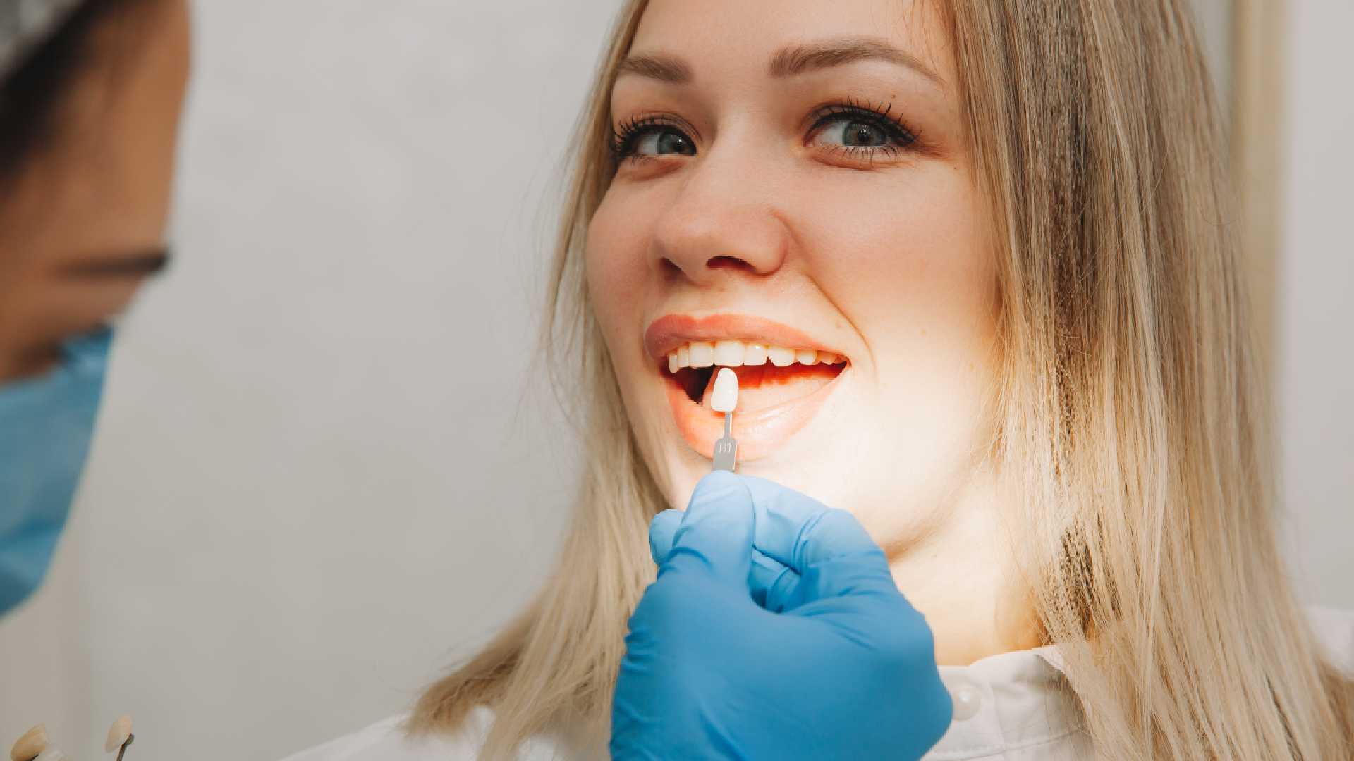 The Powerful Benefits of Dental Crown for Cracked Tooth Repair