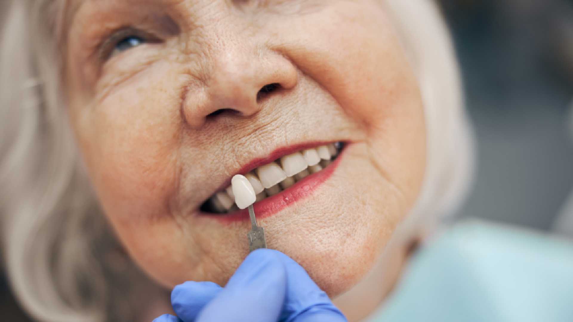 Top Broken Denture Repair Methods to Regain Confidence