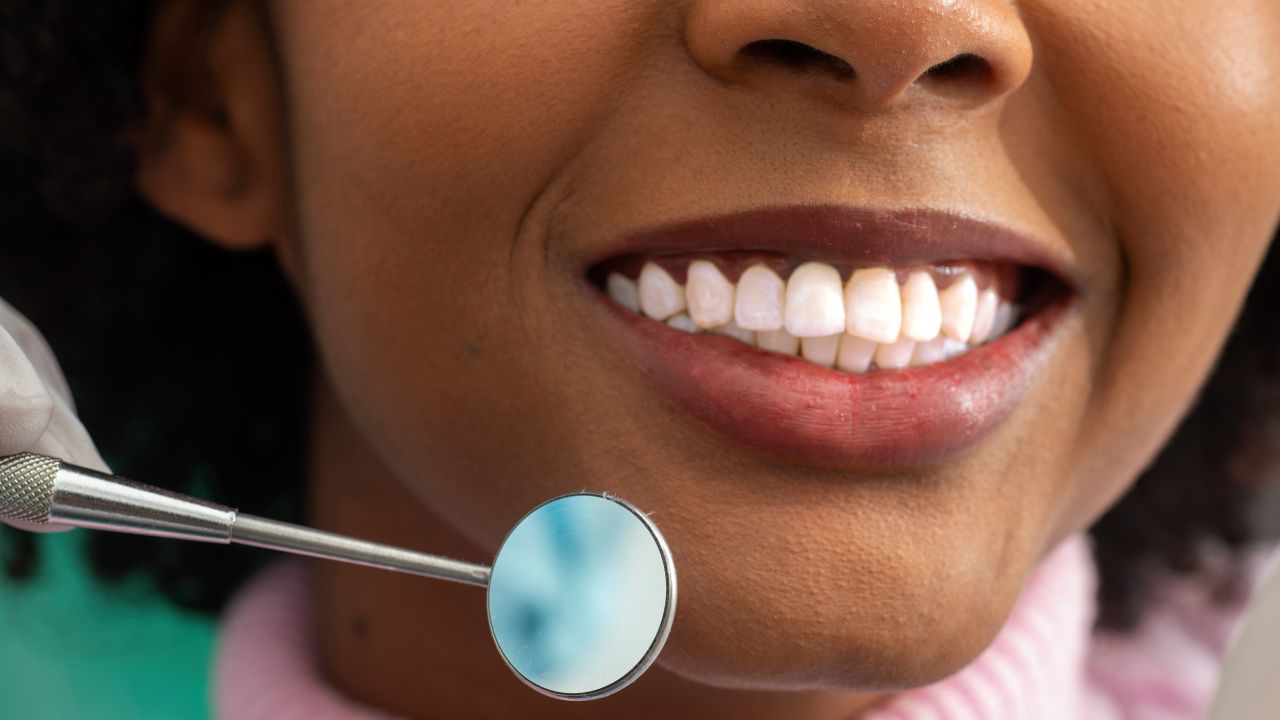 Top Denture Repair Services for Long-Lasting Results