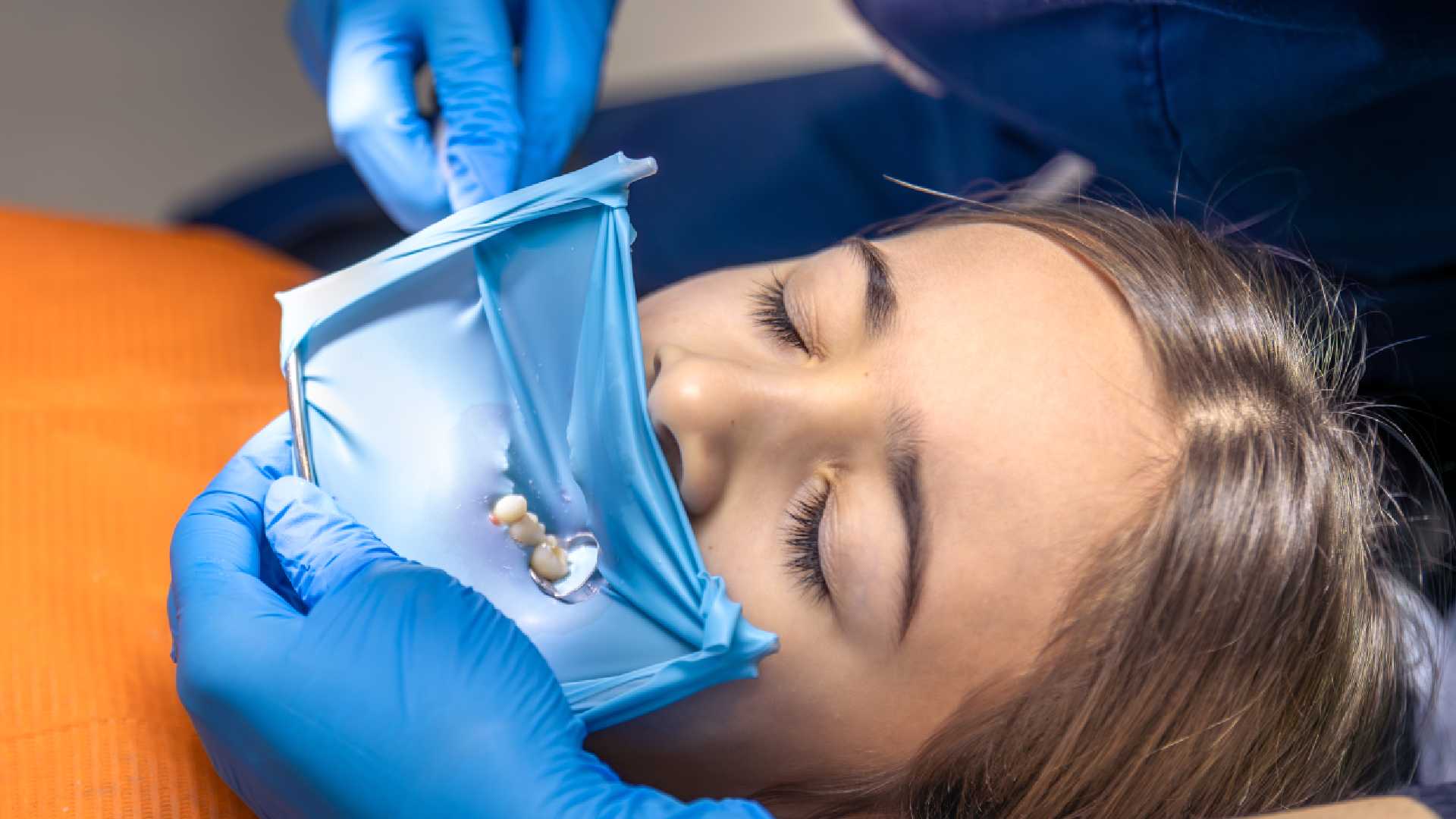 What You Need to Know About Lost Crown Emergency Repair